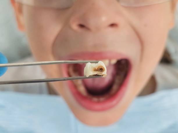 Best Urgent Tooth Repair  in James Island, SC