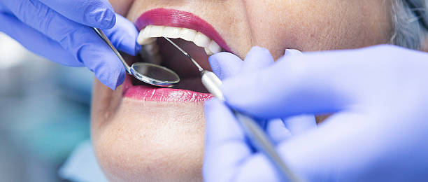 Best Root Canal Emergency Dentist  in James Island, SC